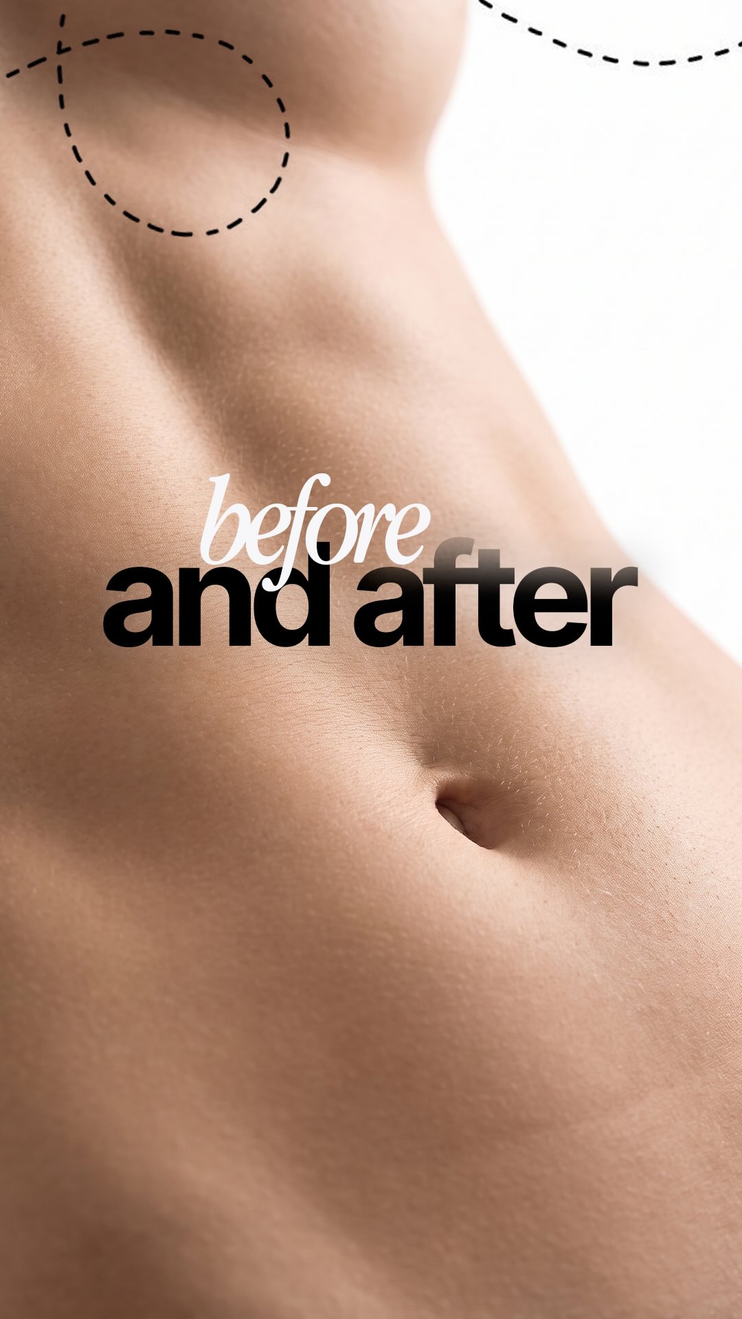 ✨ From confidence imagined... to confidence achieved.
A beautifully balanced transformation with Bre